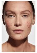 Крем «Niacinamide Мagnolia extract» с маслом лаванды