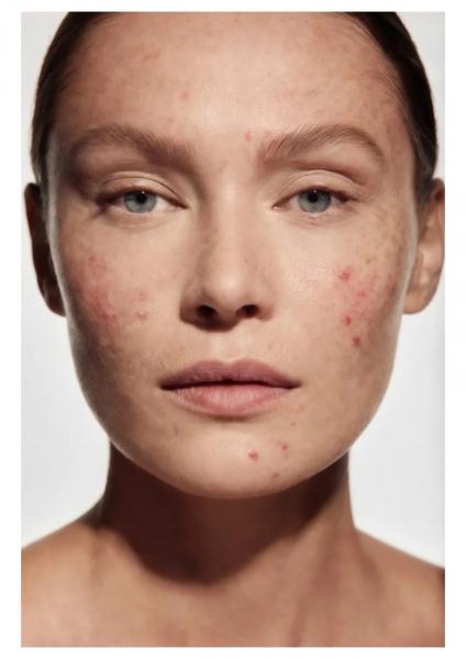 Крем «Niacinamide Мagnolia extract» с маслом лаванды - before